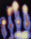 Il grande inganno della macchina Kirlian